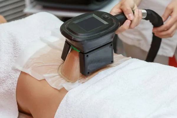 Image of person having fat freezing treatment to help weight gain Chelmsford