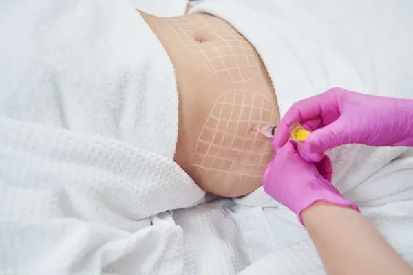 image of fat dissolving injections on love handles to help combat weight gain Chelmsford