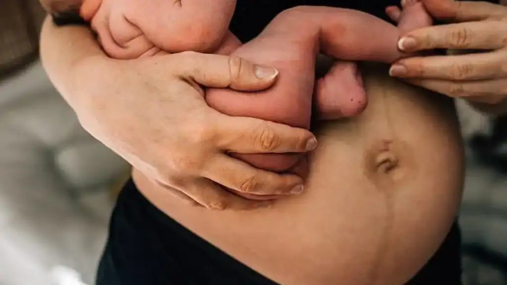 Why Is My Stomach Still Big After Pregnancy Chelmsford?
